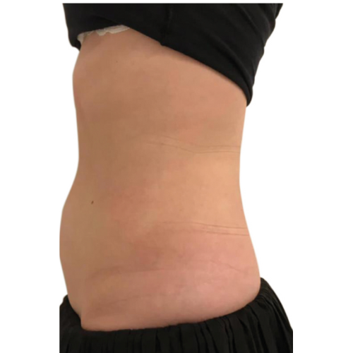 Beautywaves-Praxis-für-nicht-invasive-Behandlungen-Hautstraffung-Körperformung-HIFEM-Shockwave-IPL-Leinfelden-Echterdingen