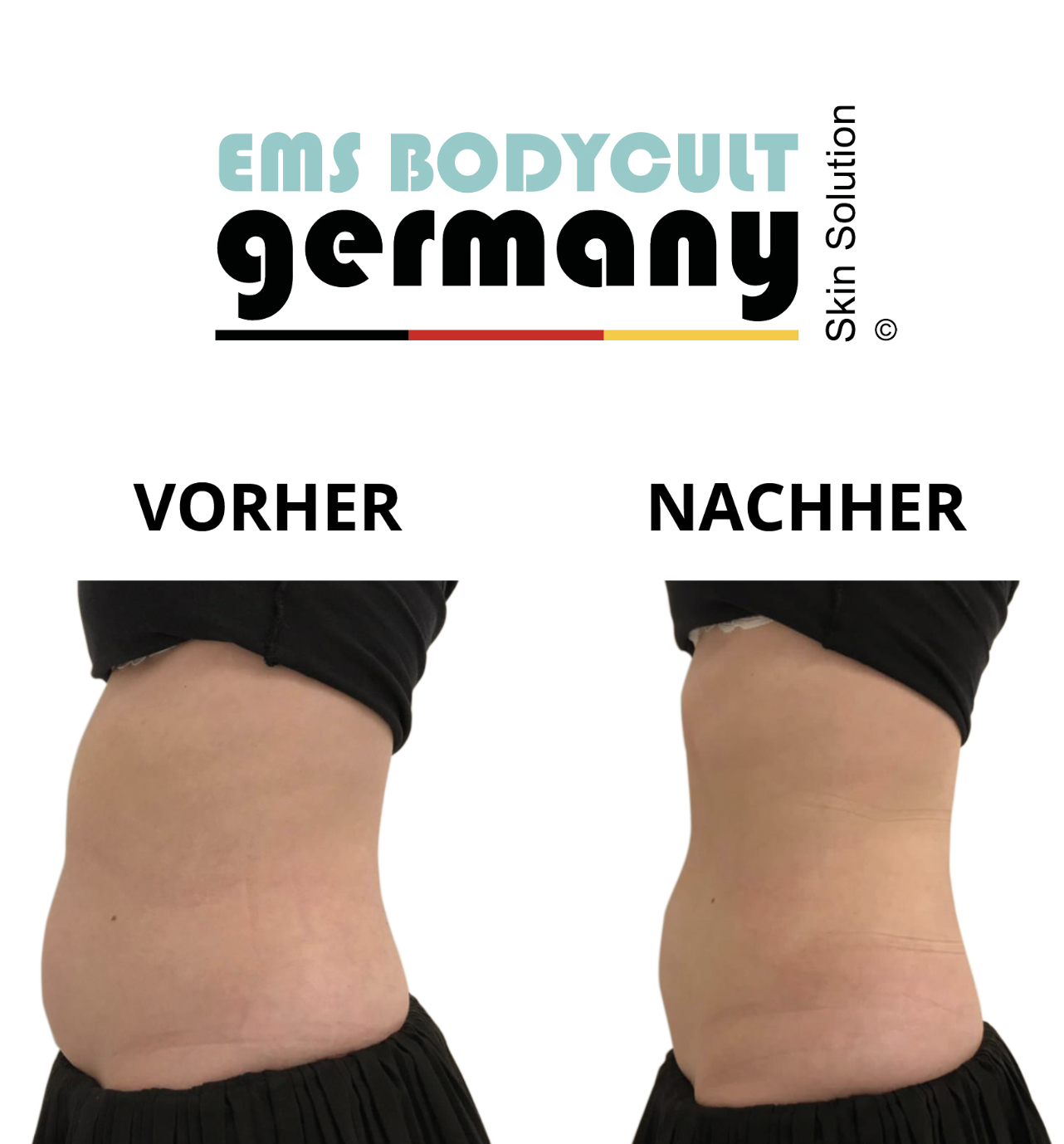 Beautywaves-Praxis-für-nicht-invasive-Behandlungen-Hautstraffung-Körperformung-HIFEM-Shockwave-IPL-Leinfelden-Echterdingen