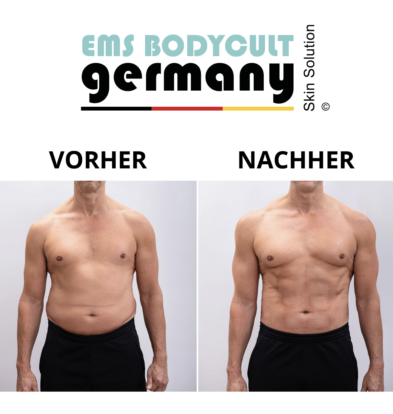 Beautywaves-Praxis-für-nicht-invasive-Behandlungen-Hautstraffung-Körperformung-HIFEM-Shockwave-IPL-Leinfelden-Echterdingen